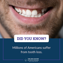 Smiling person highlighting tooth loss awareness.