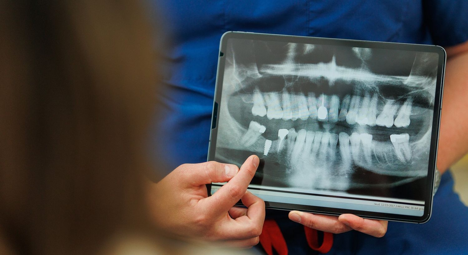 Dentist showing dental X-ray on tablet device.